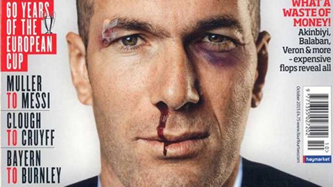 Zidane bị đánh chảy máu mũi, bầm tím mắt? Zidane bị đánh chảy máu mũi, bầm tím mắt?
