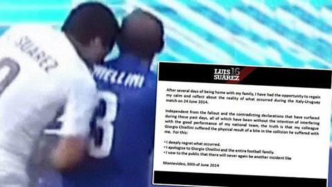 Vụ việc Luis Suarez cắn vai Chiellini vẫn còn nóng bỏng những ngày qua
