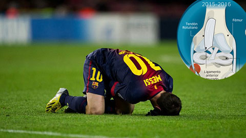 Hình ảnh chấn thương (ảnh nhỏ) đứt dây chằng đầu gối trái của Messi